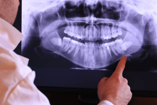 Best Emergency Wisdom Teeth Removal in Vinco, PA